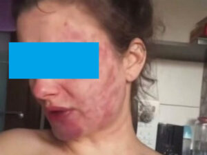 Подробнее о статье Бил головой о руль, истязал и душил: калининградку преследует бывший муж