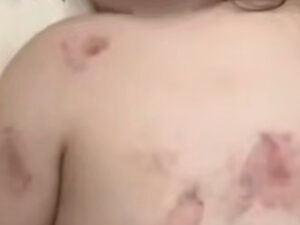 Подробнее о статье Малышку зверски искусали в детском саду в отсутствии воспитателя